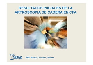 RESULTADOS INICIALES DE LA
ARTROSCOPIA DE CADERA EN CFA
DRS. Monje, Couceiro, Arriaza
 