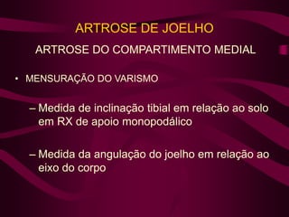 ARTROSE DE JOELHO
ARTROSE DO COMPARTIMENTO MEDIAL
• MENSURAÇÃO DO VARISMO
– Medida de inclinação tibial em relação ao solo
em RX de apoio monopodálico
– Medida da angulação do joelho em relação ao
eixo do corpo
 