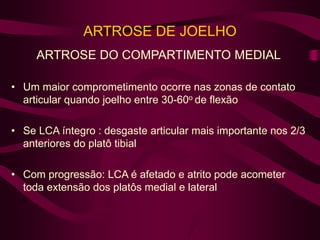 ARTROSE DE JOELHO
ARTROSE DO COMPARTIMENTO MEDIAL
• Um maior comprometimento ocorre nas zonas de contato
articular quando joelho entre 30-60o de flexão
• Se LCA íntegro : desgaste articular mais importante nos 2/3
anteriores do platô tibial
• Com progressão: LCA é afetado e atrito pode acometer
toda extensão dos platôs medial e lateral
 