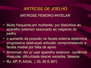 ARTROSE DE JOELHO
ARTROSE FEMORO-PATELAR
• Muito frequente,em mulheres, por distúrbios do
aparelho extensor associado ao valgismo do
joelho
• o aumento da pressão na faceta externa determina
progressiva destruiçaõ articular, comprometendo a
faceta medial por falta de apoio
• Sintomas: dor p/ usar aparelho extensor, potência
muscular, dificuldade descer escadas, falseios
• Rx: AP, P, AXIAL ( 30, 60 E 90o)
 