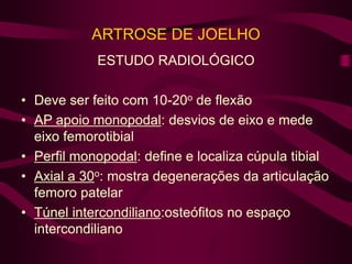 ARTROSE DE JOELHO
ESTUDO RADIOLÓGICO
• Deve ser feito com 10-20o de flexão
• AP apoio monopodal: desvios de eixo e mede
eixo femorotibial
• Perfil monopodal: define e localiza cúpula tibial
• Axial a 30o: mostra degenerações da articulação
femoro patelar
• Túnel intercondiliano:osteófitos no espaço
intercondiliano
 