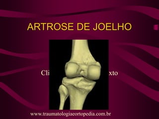 Clique para adicionar texto
ARTROSE DE JOELHO
www.traumatologiaeortopedia.com.br
 