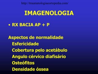 IMAGENOLOGIA
• RX BACIA AP + P
Aspectos de normalidade
Esfericidade
Cobertura pelo acetábulo
Angulo cérvico diafisário
Osteófitos
Densidade óssea
http://traumatologiaeortopedia.com/
 