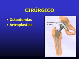 CIRÚRGICO
• Osteotomias
• Artroplastias
 