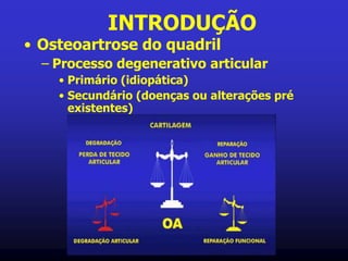 INTRODUÇÃO
• Osteoartrose do quadril
– Processo degenerativo articular
• Primário (idiopática)
• Secundário (doenças ou alterações pré
existentes)
 