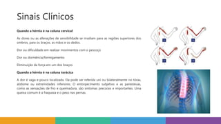 Sinais Clínicos
Quando a hérnia é na coluna cervical:
As dores ou as alterações de sensibilidade se irradiam para as regiões superiores dos
ombros, para os braços, as mãos e os dedos.
Dor ou dificuldade em realizar movimentos com o pescoço
Dor ou dormência/formigamento
Diminuição da força em um dos braços
Quando a hérnia é na coluna torácica
A dor é vaga e pouco localizada. Ela pode ser referida uni ou bilateralmente no tórax,
abdome ou extremidades inferiores. O entorpecimento subjetivo e as parestesias,
como as sensações de frio e queimadura, são sintomas precoces e importantes. Uma
queixa comum é a fraqueza e o peso nas pernas.
 