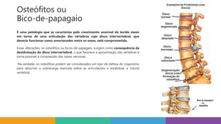 Osteófitos ou
Bico-de-papagaio
É uma patologia que se caracteriza pelo crescimento anormal de tecido ósseo
em torno de uma articulação das vértebras cujo disco intervertebral, que
deveria funcionar como amortecedor entre os ossos, está comprometida.
Essas alterações, os osteófitos ou bicos-de-papagaio, surgem como consequência da
desidratação do disco intervertebral, o que favorece a aproximação das vértebras e
torna possível a compressão das raízes nervosas.
Na verdade, os osteófitos podem ser considerados um tipo de defesa do organismo
para absorver a sobrecarga exercida sobre as articulações e estabilizar a coluna
vertebral.
 