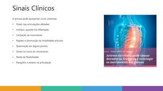 Sinais Clínicos
A artrose pode apresentar como sintomas:
• Dores nas articulações afetadas
• Inchaço, quando há inflamação
• Limitação de movimento
• Rigidez e diminuição da mobilidade articular
• Queimação em alguns pontos
• Dores no início do movimento
• Perda de flexibilidade
• Rangidos e estalos na articulação
 