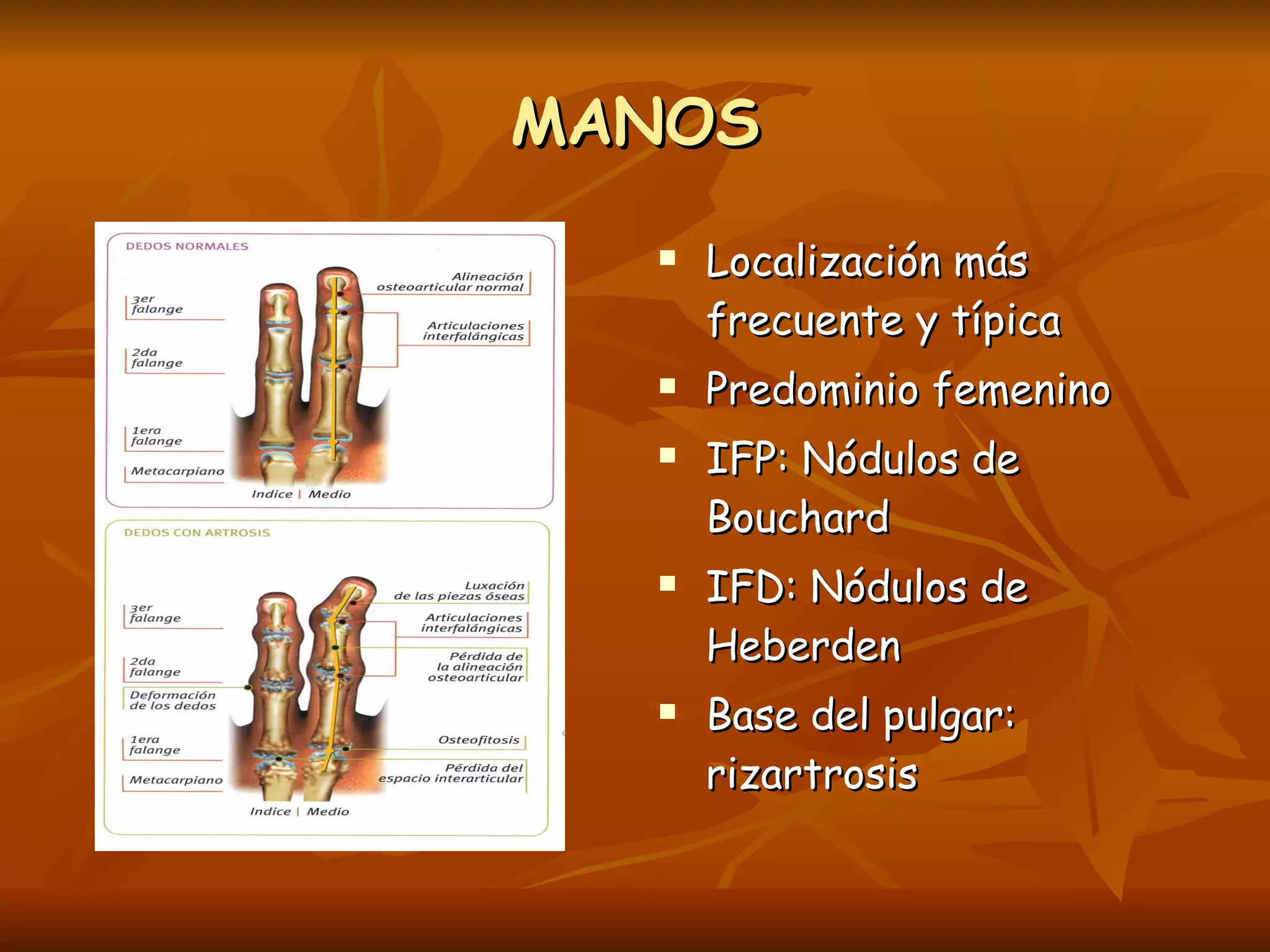 MANOS Localización más frecuente y típica Predominio femenino IFP: Nódulos de Bouchard IFD: Nódulos de Heberden Base del pulgar: rizartrosis 