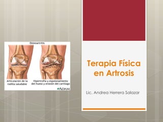 Terapia Física
en Artrosis
Lic. Andrea Herrera Salazar

 