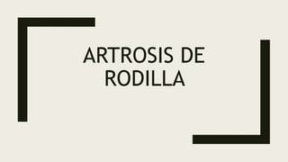 ARTROSIS DE
RODILLA
 