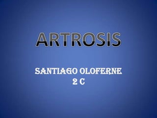 ARTROSIS Santiago oloferne2 C 