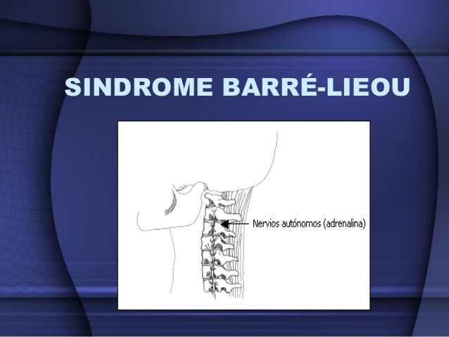 Artrosis cervical dr. sandy cadena