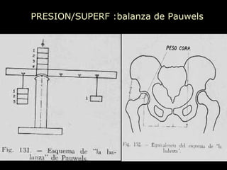 PRESION/SUPERF :balanza de Pauwels 