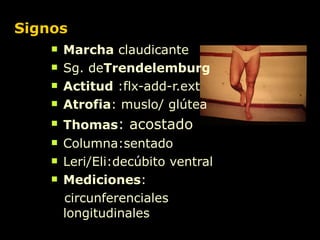 Signos Marcha  claudicante  Sg. de Trendelemburg  Actitud  :flx-add-r.ext Atrofia : muslo/ glútea Thomas : acostado Columna:sentado Leri/Eli:decúbito ventral Mediciones : circunferenciales  longitudinales 