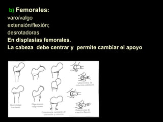 b)   Femorales :  varo/valgo extensión/flexión;  desrotadoras  En displasias femorales.  La cabeza  debe centrar y  permite cambiar el apoyo 