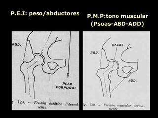 P.E.I: peso/abductores P.M.P:tono muscular (Psoas-ABD-ADD) 