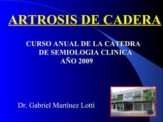 ARTROSIS DE CADERA
Dr. Gabriel Martínez Lotti
CURSO ANUAL DE LA CATEDRA
DE SEMIOLOGIA CLINICA
AÑO 2009
 