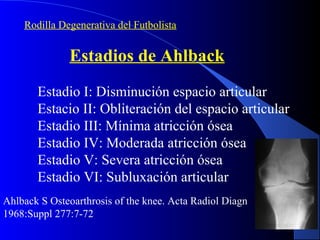 Artrosis de cadera | PPS