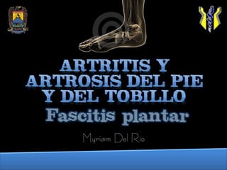 Artritis y Artrosis del pie y del tobillo Fascitis plantar Myriam Del Río 