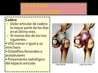 Cadera
  Dolor articular de cadera
   la mayor parte de los días
   en el último mes.
  Al menos dos de los tres
   siguientes:
• VSG menor o igual a 20
mm/ hora
• Osteofitos femorales o
acetabulares
• Pinzamiento radiológico
del espacio articular
 