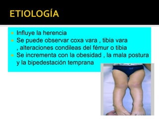  Influye la herencia
 Se puede observar coxa vara , tibia vara
  , alteraciones condileas del fémur o tibia
 Se incrementa con la obesidad , la mala postura
  y la bipedestación temprana
 