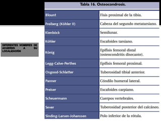 DIFERENTES NOMBRES DE
ACUERDO      A     SU
LOCALIZACIÓN
 