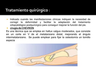 Tratamiento quirúrgico :

   Indicado cuando las manifestaciones clínicas indiquen la necesidad de
    corregir la deformidad y facilitar la adaptación del tratamiento
    ortopodológico postquirúrgico para conseguir mejorar la función del pie.
   cirugía de CHEVRON
Es una técnica que se emplea en hallux valgus moderados, que consiste
en un corte en V de el metatarsiano distal, mejorando el ángulo
intermetatarsiano. Se puede emplear para fijar la osteotomía un tornillo
especia
 
