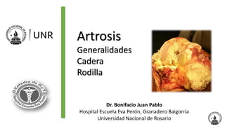 Artrosis
Generalidades
Cadera
Rodilla
Dr. Bonifacio Juan Pablo
Hospital Escuela Eva Perón, Granadero Baigorria
Universidad Nacional de Rosario
 
