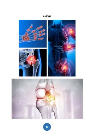 22
ANEXO
 