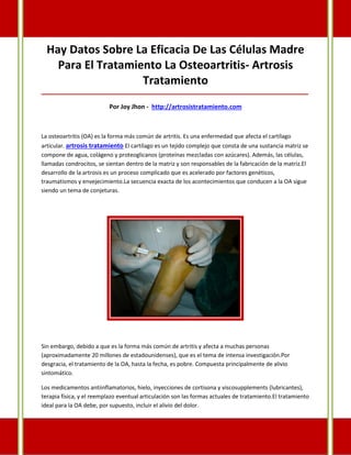 Hay Datos Sobre La Eficacia De Las Células Madre
Para El Tratamiento La Osteoartritis- Artrosis
Tratamiento
_____________________________________________________________________________________
Por Joy Jhon - http://artrosistratamiento.com
La osteoartritis (OA) es la forma más común de artritis. Es una enfermedad que afecta el cartílago
articular. artrosis tratamiento El cartílago es un tejido complejo que consta de una sustancia matriz se
compone de agua, colágeno y proteoglicanos (proteínas mezcladas con azúcares). Además, las células,
llamadas condrocitos, se sientan dentro de la matriz y son responsables de la fabricación de la matriz.El
desarrollo de la artrosis es un proceso complicado que es acelerado por factores genéticos,
traumatismos y envejecimiento.La secuencia exacta de los acontecimientos que conducen a la OA sigue
siendo un tema de conjeturas.
Sin embargo, debido a que es la forma más común de artritis y afecta a muchas personas
(aproximadamente 20 millones de estadounidenses), que es el tema de intensa investigación.Por
desgracia, el tratamiento de la OA, hasta la fecha, es pobre. Compuesta principalmente de alivio
sintomático.
Los medicamentos antiinflamatorios, hielo, inyecciones de cortisona y viscosupplements (lubricantes),
terapia física, y el reemplazo eventual articulación son las formas actuales de tratamiento.El tratamiento
ideal para la OA debe, por supuesto, incluir el alivio del dolor.
 