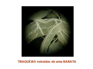 TRAQUÉIAS extraídas de uma BARATA 