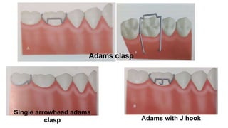 REMOVABLE APPLIENCE BY DR ARUNESH VERMA KGMU .pptx