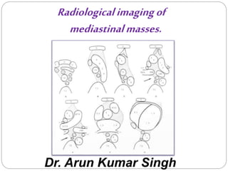 Radiological imaging of 
mediastinal masses. 
Dr. Arun Kumar Singh 
 