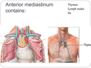 Anterior mediastinum 
contains: 
Thymus 
Lymph nodes 
fat 
 