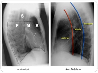 anatomical Acc. To felson 
 