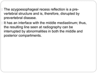 The azygoesophageal recess reflection is a pre-vertebral 
structure and is, therefore, disrupted by 
prevertebral disease. 
It has an interface with the middle mediastinum; thus, 
the resulting line seen at radiography can be 
interrupted by abnormalities in both the middle and 
posterior compartments. 
 
