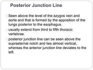 Posterior Junction Line 
Seen above the level of the azygos vein and 
aorta and that is formed by the apposition of the 
lungs posterior to the esophagus. 
usually extend from third to fifth thoracic 
vertebrae. 
posterior junction line can be seen above the 
suprasternal notch and lies almost vertical, 
whereas the anterior junction line deviates to the 
left. 
 