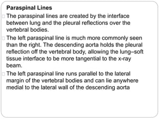 Paraspinal Lines 
The paraspinal lines are created by the interface 
between lung and the pleural reflections over the 
vertebral bodies. 
The left paraspinal line is much more commonly seen 
than the right. The descending aorta holds the pleural 
reflection off the vertebral body, allowing the lung–soft 
tissue interface to be more tangential to the x-ray 
beam. 
The left paraspinal line runs parallel to the lateral 
margin of the vertebral bodies and can lie anywhere 
medial to the lateral wall of the descending aorta 
 