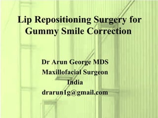 Dr Arun George MDS
Maxillofacial Surgeon
India
drarun1g@gmail.com
Lip Repositioning Surgery for
Gummy Smile Correction
 