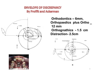 Orthodontics – 6mm,
Orthopaedics plus Ortho _
12 mm
Orthognathics - 1.5 cm
Distraction- 2.5cm
Distraction - 2.5 cm
2
 