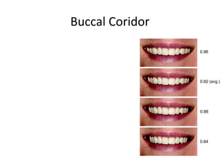 Buccal Coridor
 