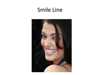 Smile Line
 
