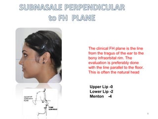 The clinical FH plane is the line
from the tragus of the ear to the
bony infraorbital rim. The
evaluation is preferably done
with the line parallel to the floor.
This is often the natural head
Upper Lip- 0mm
Lower Lip- 2mmm
Upper Lip -0
Lower Lip -2
Menton -4
9
 