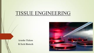 TISSUE ENGINEERING
Arushe Tickoo
B.Tech Biotech
 