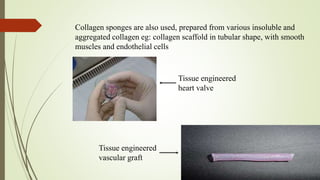 Collagen sponges are also used, prepared from various insoluble and
aggregated collagen eg: collagen scaffold in tubular shape, with smooth
muscles and endothelial cells
Tissue engineered
heart valve
Tissue engineered
vascular graft
 