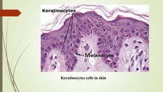 Keratinocytes cells in skin
 
