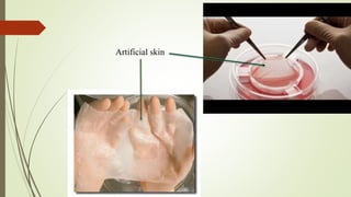 Artificial skin
 