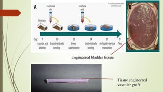 Tissue engineered
vascular graft
Engineered bladder tissue
 