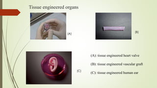 Tissue engineered organs
(A)
(B)
(C)
(A): tissue engineered heart valve
(B): tissue engineered vascular graft
(C): tissue engineered human ear
 